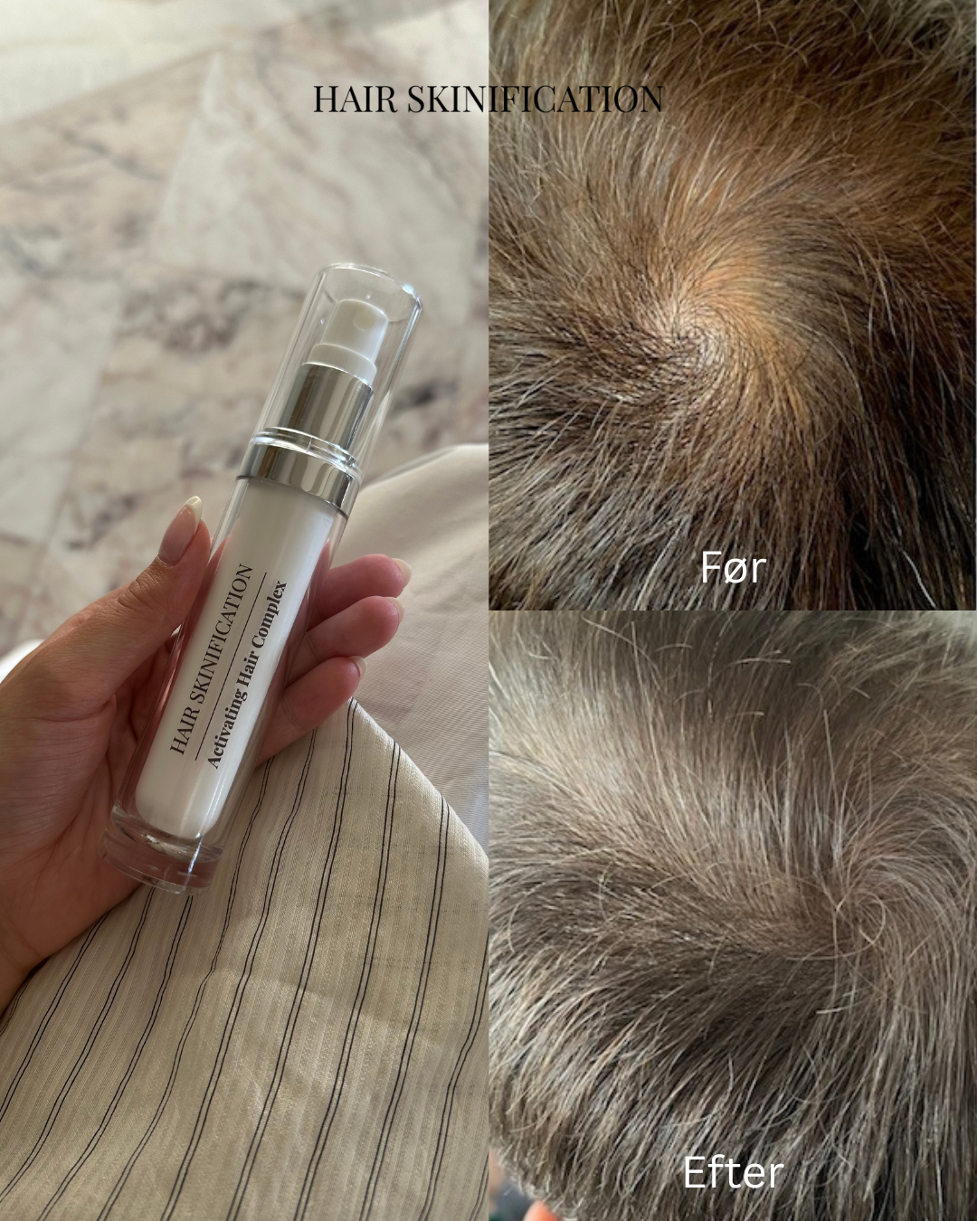 Activating Hair Complex