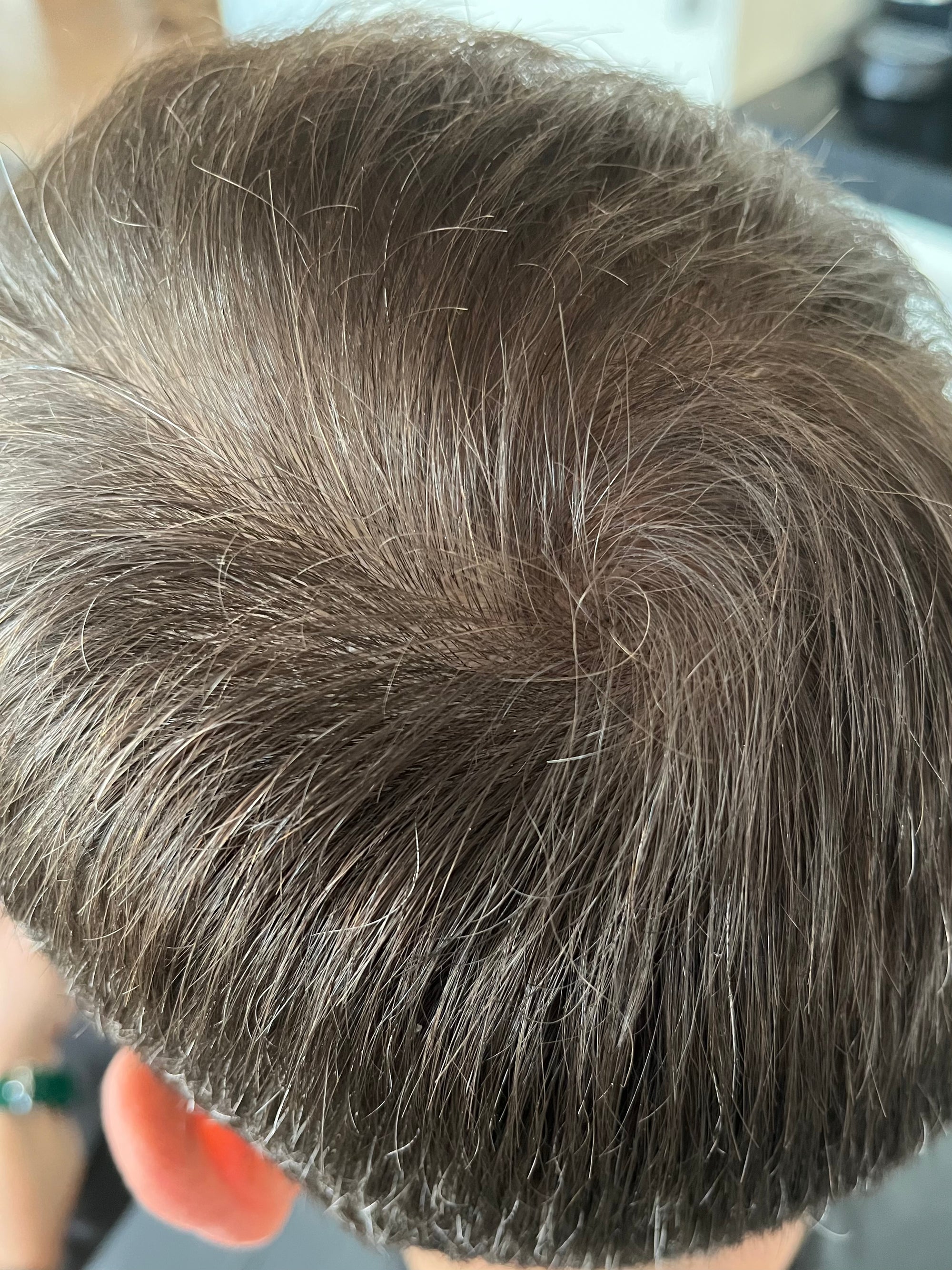 Complex efter