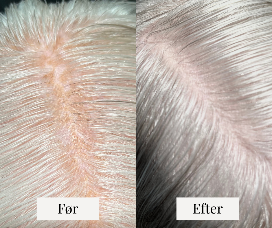 Hyaluronic Hair Skin Serum Før Efter